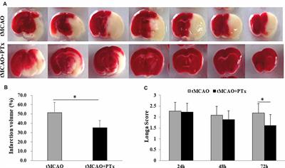 Pertussis Toxin Ameliorates Microglial Activation Associated With Ischemic Stroke